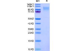ICAM-3/CD50 Protein (AA 30-485) (His tag)