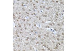 Immunohistochemistry of paraffin-embedded mouse brain using RNF166 antibody (ABIN5974659) (40x lens). (RNF166 Antikörper)