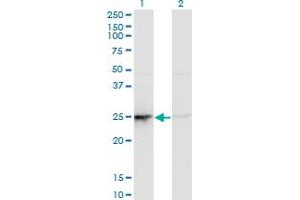 Western Blot analysis of PSMD10 expression in transfected 293T cell line by PSMD10 monoclonal antibody (M19), clone 3F10. (PSMD10 Antikörper  (AA 1-226))