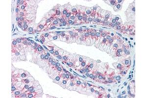 Anti-AKT1S1 / PRAS40 antibody IHC of human prostate. (PRAS40 Antikörper)