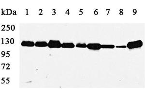Western blot analysis using PARP1 antibody against MCF(1), A549(2), HepG2(3), COS7(4),C2C12(5),A431(6),MDCK(7),PC12(8) and Jurkat cell lysate(9). (PARP1 Antikörper)