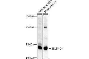 Western blot analysis of extracts of various cell lines, using SELENOK antibody (ABIN7270194) at 1:1000 dilution. (Selenoprotein K (SELENOK) Antikörper)