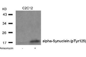 Image no. 2 for anti-Synuclein, alpha (SNCA) (pTyr125) antibody (ABIN401546) (SNCA Antikörper  (pTyr125))