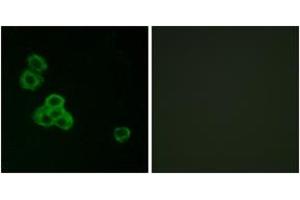 Immunofluorescence analysis of MCF7 cells, using CaMK2 alpha/delta (Ab-286) Antibody. (CaMK2 alpha/delta Antikörper  (AA 256-305))