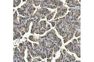 IHC analysis of hnRNP L/HNRNPL using anti-hnRNP L/HNRNPL antibody (ABIN7600130). (HNRNPL Antikörper  (AA 152-569))