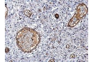 Immunohistochemistry (IHC) image for anti-Matrix Metallopeptidase 1 (Interstitial Collagenase) (MMP1) antibody (ABIN2854783)