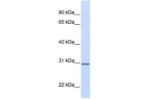 DCI antibody used at 1 ug/ml to detect target protein. (DCI Antikörper)