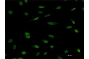 Immunofluorescence of monoclonal antibody to HCLS1 on HeLa cell. (HCLS1 Antikörper  (AA 266-355))