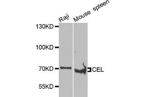 Western blot analysis of extracts of various cell lines, using CEL antibody (ABIN5975616) at 1/1000 dilution. (Cholesterol Esterase Antikörper)