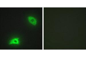 Peptide - +Immunohistochemistry analysis of paraffin-embedded human brain tissue, using DUSP6 antibody. (DUSP6 Antikörper)
