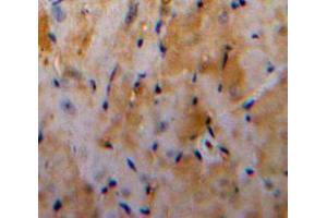 Used in DAB staining on fromalin fixed paraffin-embedded Heart tissue (Galectin 3 Antikörper  (AA 1-250))