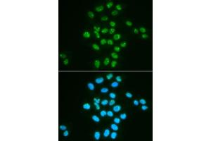 Immunofluorescence analysis of HeLa cells using Bmi1 antibody (ABIN6130877, ABIN6137590, ABIN6137592 and ABIN6217484). (BMI1 Antikörper  (AA 120-326))