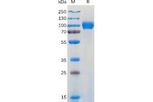 Human GM-CSFR Protein, hFc Tag on SDS-PAGE under reducing condition.