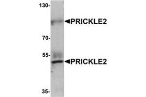 Western blot analysis of PRICKLE2 in A-20 lysate with PRICKLE2 antibody at 1 μg/mL. (PRICKLE2 Antikörper  (Middle Region))