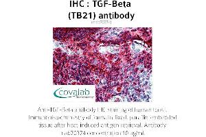 Image no. 2 for anti-TGF-beta (TGFb) antibody (ABIN1723276)