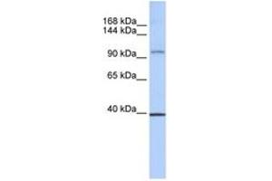 Image no. 1 for anti-RE1-Silencing Transcription Factor (REST) (AA 972-1021) antibody (ABIN6742278) (REST Antikörper  (AA 972-1021))