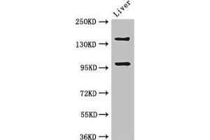 Western Blot Positive WB detected in: Mouse liver tissue All lanes: PHLDB2 antibody at 3 μg/mL Secondary Goat polyclonal to rabbit IgG at 1/50000 dilution Predicted band size: 143, 137, 140 kDa Observed band size: 143, 96 kDa (PHLDB2 Antikörper  (AA 734-1030))