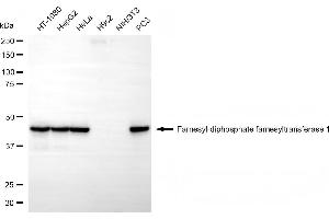 Western blotting analysis using farnesyl-diphosphate farnesyltransferase 1 antibody (ABIN7798570). (FDFT1 Antikörper)