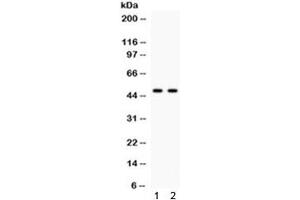 Western blot testing of human 1) HeLa and 2) COLO320 cell lysate with JNK2 antibody.