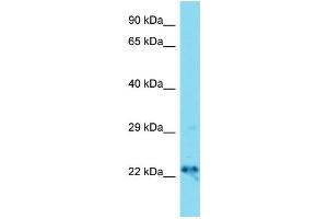 Host: Rabbit  Target Name: Dnajc12  Sample Tissue: Mouse Brain lysates  Antibody Dilution: 1. (DNAJC12 Antikörper  (Middle Region))