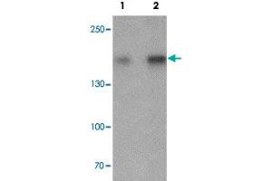 Western blot analysis of Jurkat cell lysate with CRIM2 polyclonal antibody  at (1) 1 and (2) 2 ug/mL.