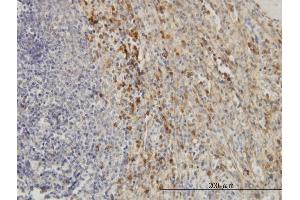 Immunoperoxidase of monoclonal antibody to TIMP2 on formalin-fixed paraffin-embedded human spleen. (TIMP2 Antikörper  (AA 27-220))