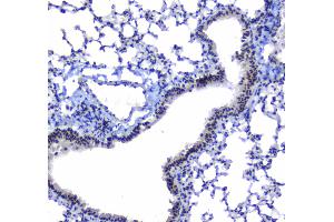 Immunohistochemistry (IHC) image for anti-Splicing Factor 1 (SF1) (AA 160-266) antibody (ABIN5692946)