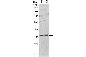 Western Blot showing PPP1A antibody used against Hela (1) and NIH/3T3 (2) cell lysate. (PPP1CA Antikörper)