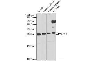 Western blot analysis of extracts of various cell lines using BAK1 Polyclonal Antibody at dilution of 1:1000. (BAK1 Antikörper)