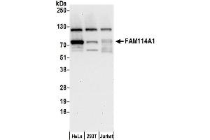 Western Blotting (WB) image for anti-Family with Sequence Similarity 114, Member A1 (FAM114A1) (AA 75-125) antibody (ABIN7452606)