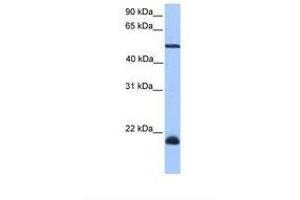 Image no. 1 for anti-Dyslexia Susceptibility 1 Candidate 1 (DYX1C1) (AA 301-350) antibody (ABIN6739367) (DYX1C1 Antikörper  (AA 301-350))