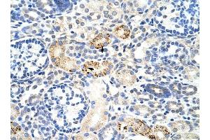 RBM4B antibody was used for immunohistochemistry at a concentration of 4-8 ug/ml to stain Epithelial cells of renal tubule (arrows) in Human Kidney. (RBM4B Antikörper  (C-Term))