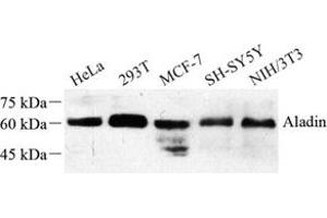 Western blot analysis of Aladin (ABIN7072884) at dilution of 1: 500