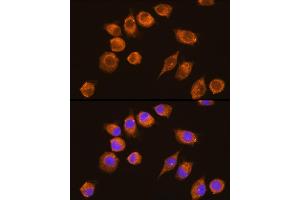 Immunofluorescence analysis of L929 cells using NAGA Rabbit pAb (ABIN6133352, ABIN6144342, ABIN6144343 and ABIN6225273) at dilution of 1:100 (40x lens).