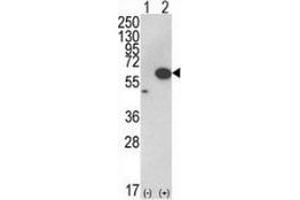 Western blot analysis of AKT1 (arrow) in 293 cell lysates (2 ug/lane) either nontransfected (Lane 1) or transiently transfected with the AKT1 gene (Lane 2) using AKT1 / PKB Antibody (C-term). (AKT1 Antikörper  (C-Term))