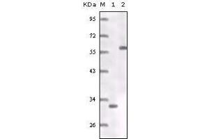 Western Blot showing ER antibody truncated ER recombinant protein (1) MCF-7 cell lysates (2). (Estrogen Receptor alpha Antikörper)