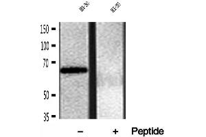 Western blot analysis of extracts of HEK-293 cells, using FKBP65 antibody. (FKBP10 Antikörper)