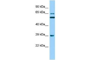Host: Rabbit Target Name: RAB19 Sample Type: RPMI-8226 Whole Cell lysates Antibody Dilution: 1. (RAB19 Antikörper  (N-Term))