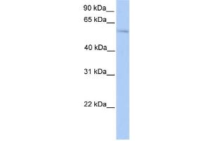 WB Suggested Anti-PLAG1 Antibody Titration:  0. (PLAG1 Antikörper  (N-Term))
