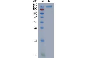 Human OSMR Protein, His Tag on SDS-PAGE under reducing condition.