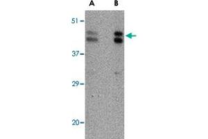Western blot analysis of FBXL20 in A-20 cell lysate with FBXL20 polyclonal antibody  at (A) 0. (FBXL20 Antikörper  (C-Term))