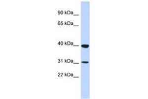 Image no. 1 for anti-Zinc Finger Protein 660 (ZNF660) (N-Term) antibody (ABIN6742930) (ZNF660 Antikörper  (N-Term))