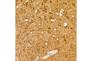 Immunohistochemistry of paraffin-embedded mouse brain using ENO2 Rabbit mAb (ABIN7266959) at dilution of 1:100 (40x lens). (ENO2/NSE Antikörper)