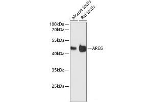 Western blot analysis of extracts of various cell lines using AREG Polyclonal Antibody at dilution of 1:3000. (Amphiregulin Antikörper)