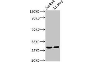 Western Blot Positive WB detected in: Jurkat whole cell lysate, Rat kidney tissue All lanes: MSX2 antibody at 2 μg/mL Secondary Goat polyclonal to rabbit IgG at 1/50000 dilution Predicted band size: 29 kDa Observed band size: 29 kDa (Msx2/Hox8 Antikörper  (AA 50-120))