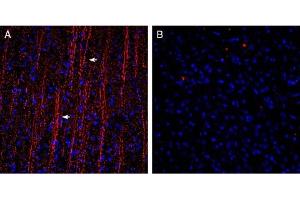Expression of P2Y12 in rat parietal cortex.
