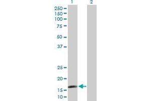 Western Blot analysis of CAMP expression in transfected 293T cell line by CAMP MaxPab polyclonal antibody. (Cathelicidin Antikörper  (AA 31-170))