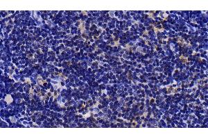 Immunohistochemistry (IHC) image for anti-Mitogen-Activated Protein Kinase Kinase 4 (MAP2K4) (AA 137-394) antibody (ABIN7439399)