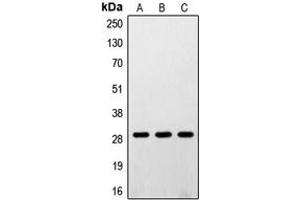 Western blot analysis of RPS4Y1 expression in A431 (A), K562 (B), HEK293 (C) whole cell lysates.