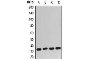 Western blot analysis of IGFBP5 expression in PC3 (A), BT474 (B), mouse kidney (C), mouse lung (D) whole cell lysates. (IGFBP5 Antikörper)